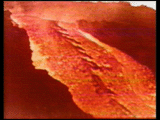 Inferno lava flow